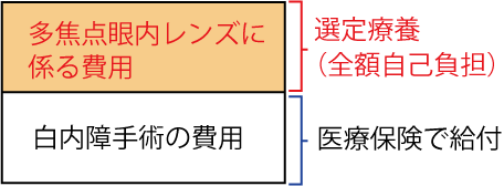 多焦点眼内レンズを使用する白内障手術の費用